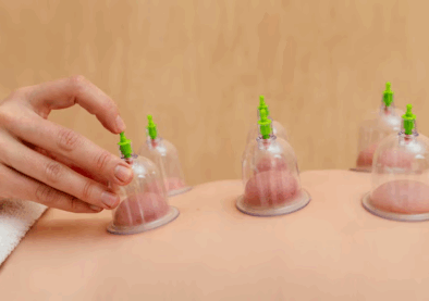 patient-experiencing-cupping-therapy_23-2148882159